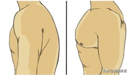 胸肌比较发达而背肌比较弱会造成什么后果，穿衣服的时候有点怪？